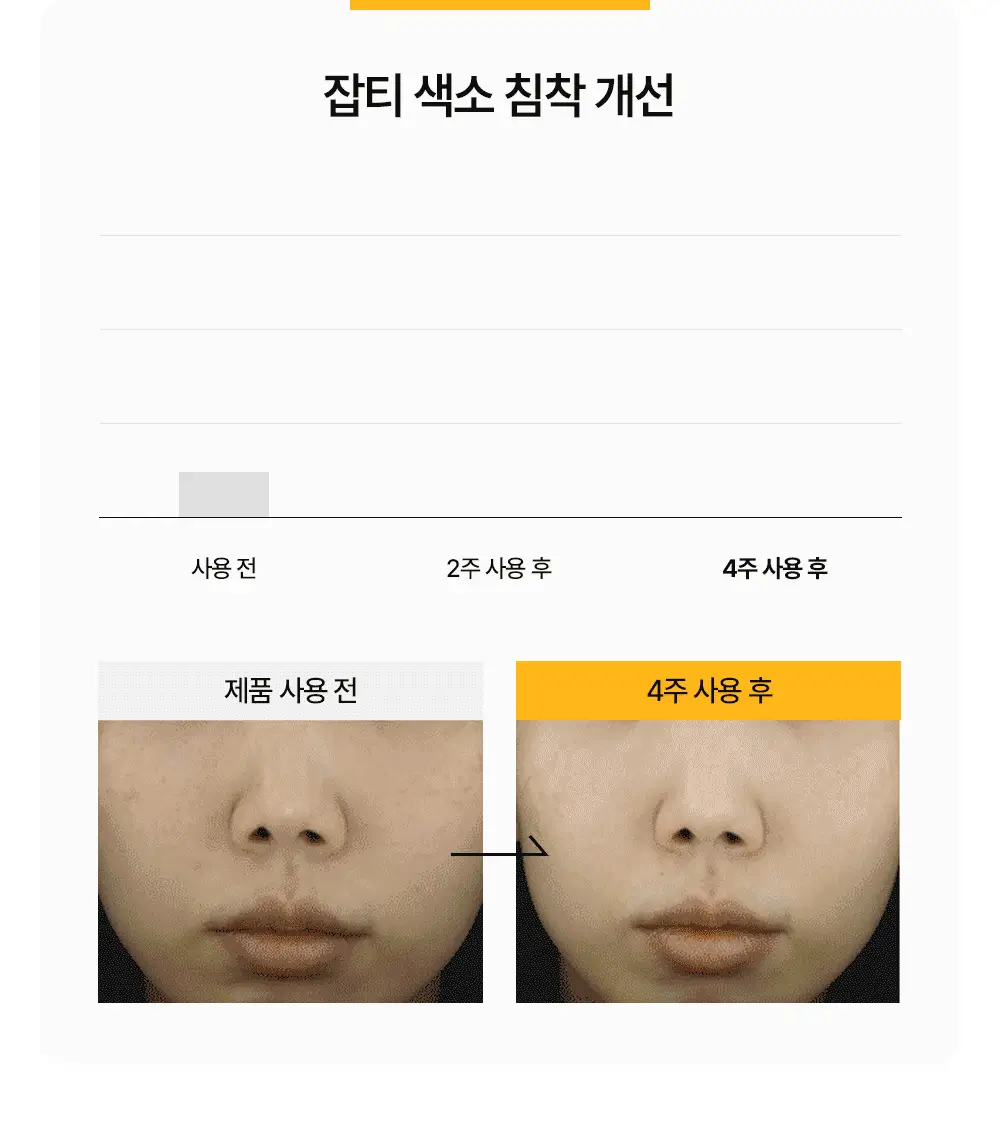 [기미/잡티/미백] 원진이펙트 멜라리스 크림 80g 상세페이지 18
